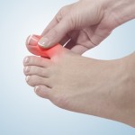 gout-causes