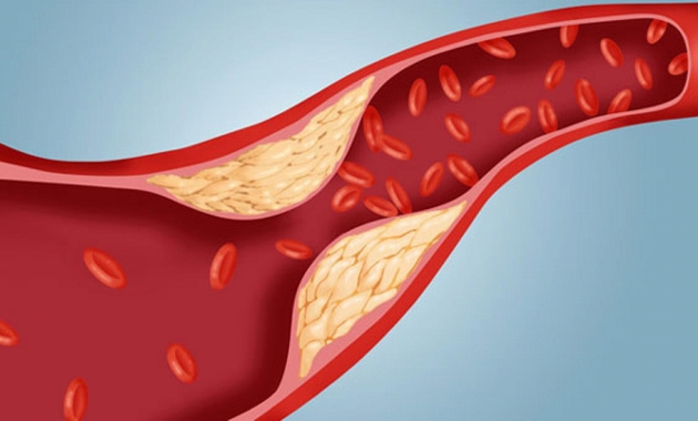 what-causes-damage-to-blood-vessels